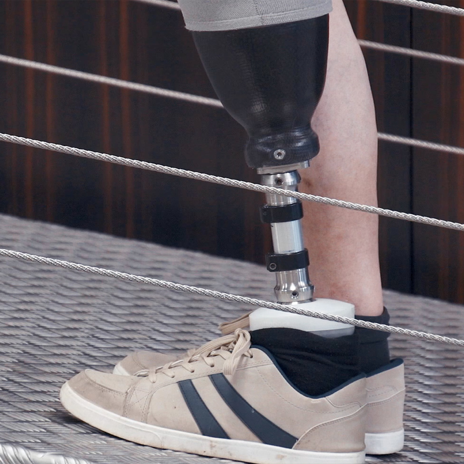 Detail view of the leg of a user, who is standing on a ramp with the Meridium prosthetic foot.