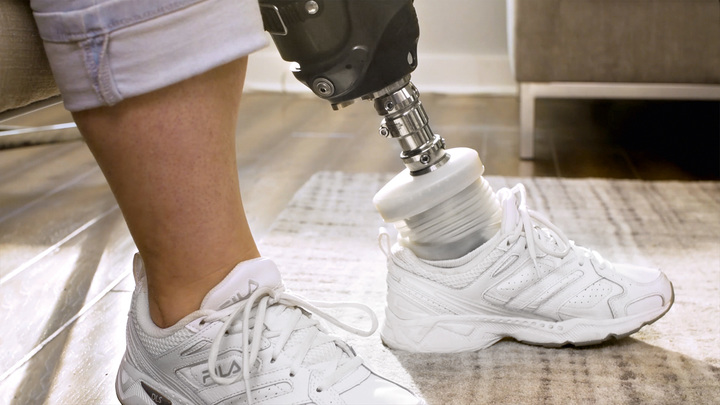 The Meridium prosthetic foot lowers itself to the floor when sitting.