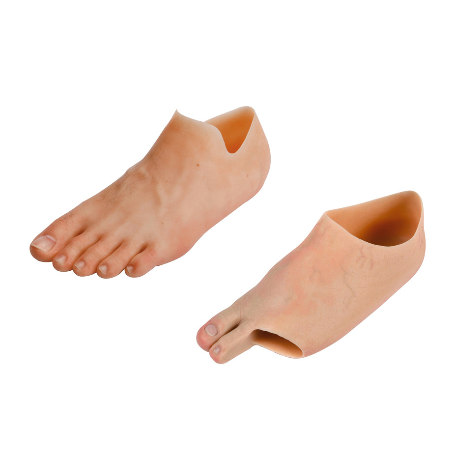 Custom silicone partial foot prosthesis and toe prosthesis