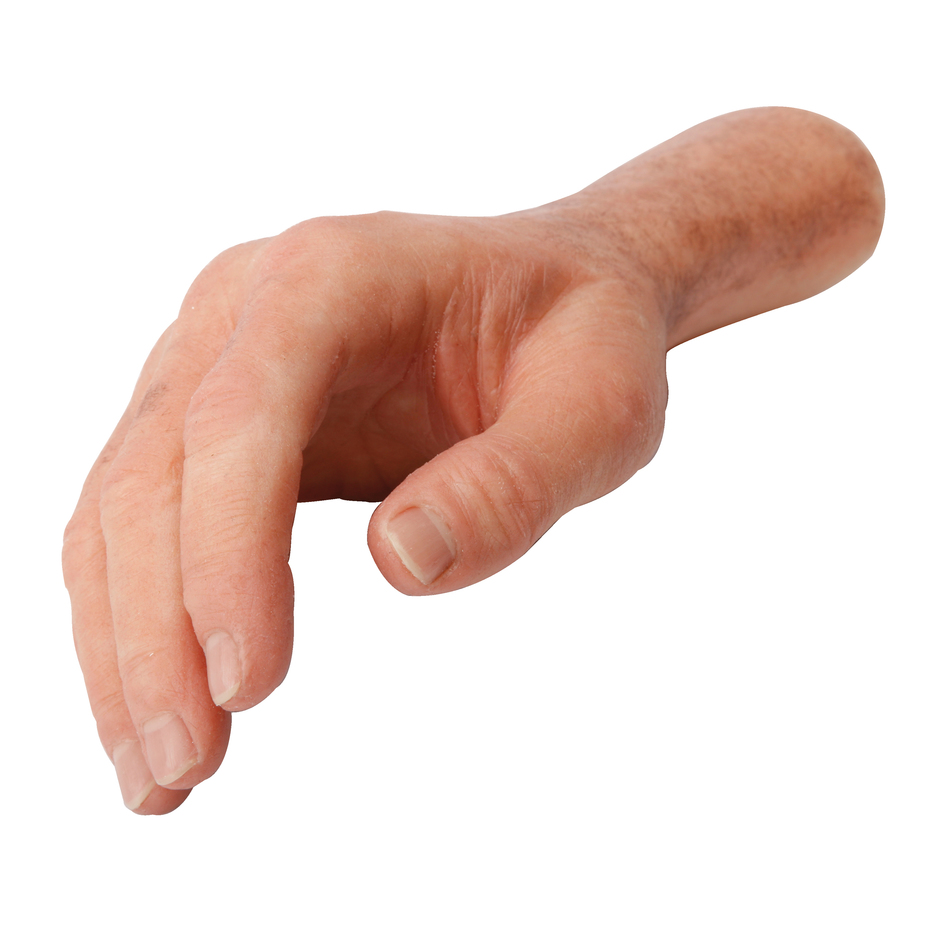 Handprothesen-88A2
