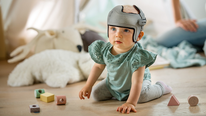 Bebé con órtesis craneal impresa en 3D MyCRO Band mientras juega