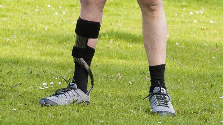 Man wears the orthosis in standard shoes