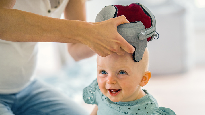 Baby wird mit seiner 3D-gedruckten MyCRO Helm Kranial-Orthese versorgt