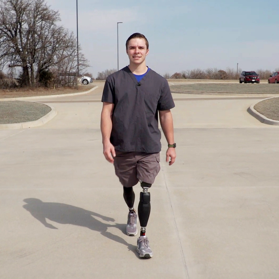 Opens video: "Seth walks with the Genium X3 from Ottobock"